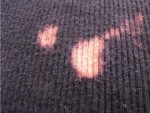 Remove Bleach Stains from Clothes
