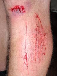 making your self bleed without pain