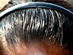 Greasy Hairs