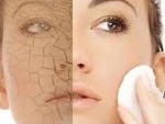 Get Rid Of Dry Skin On Face