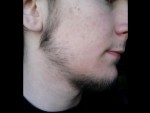 Beard to Grow Faster