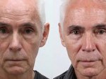 How to Get Face Fat