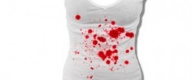 How to Remove Dye From Clothes