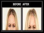 How to Make Forehead Look Smaller