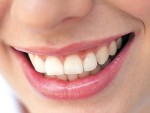 Naturally White Teeth