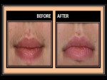 Wax an Upper Lip