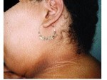 how to lose neck fat