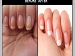 make your nails whiter