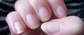 Finger Nails