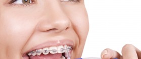 Braces
