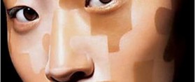White Spots On Face