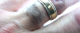 Jewellery Discolouring Skin
