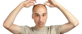 Male Baldness