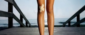 Skinned Knees