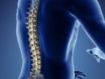 Spinal Stenosis