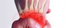 Repetitive Strain Injury