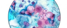 how to prevent chlamydia trachomatis