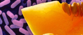 Listeria