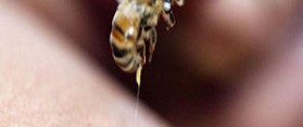 How to Treat a Wasp or Hornet Sting