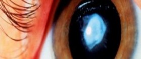 Top 10 Ways to Take Care of Your Eyes