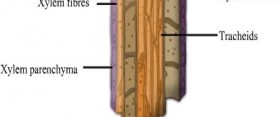 Tracheids and Vessels