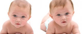 twins
