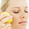 Applying Lemon Juice on Acne Scars