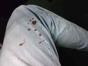 Blood Stain