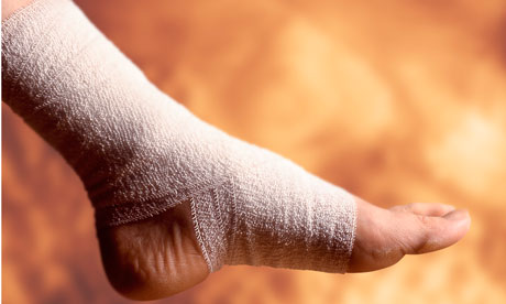 Treating a Sprained Ankle