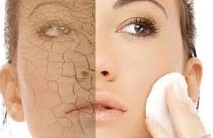 Get Rid Of Dry Skin On Face