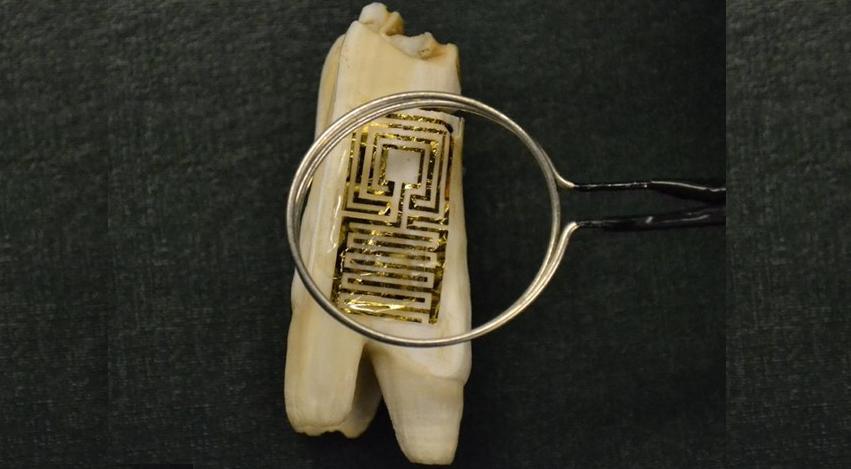 Princeton University researchers create Tooth Tattoo