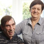 Tony Nicklinson and his wife, Jane