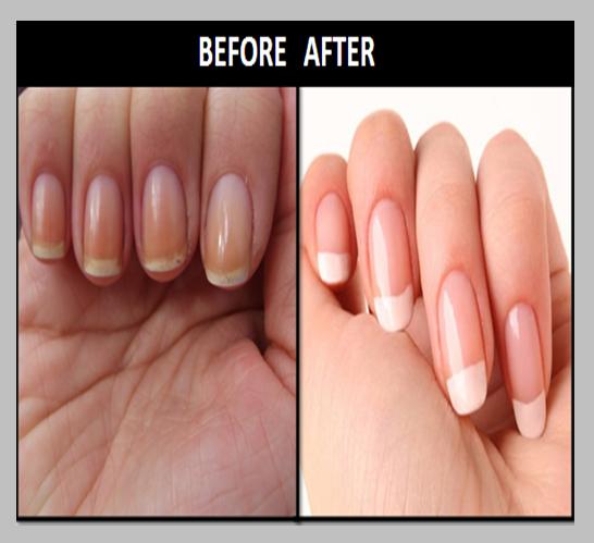 make your nails whiter