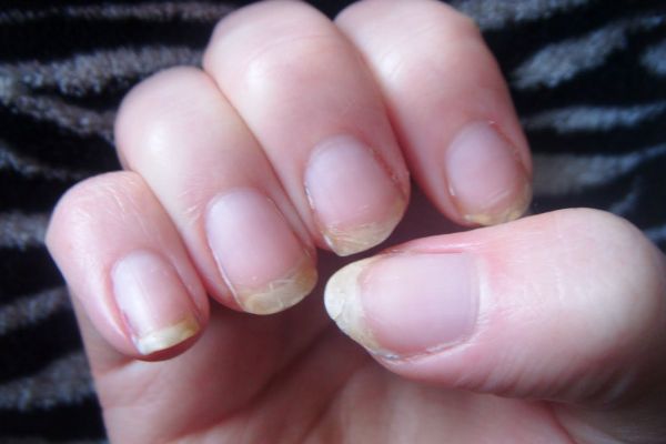 Finger Nails