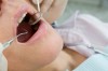 operating teeth