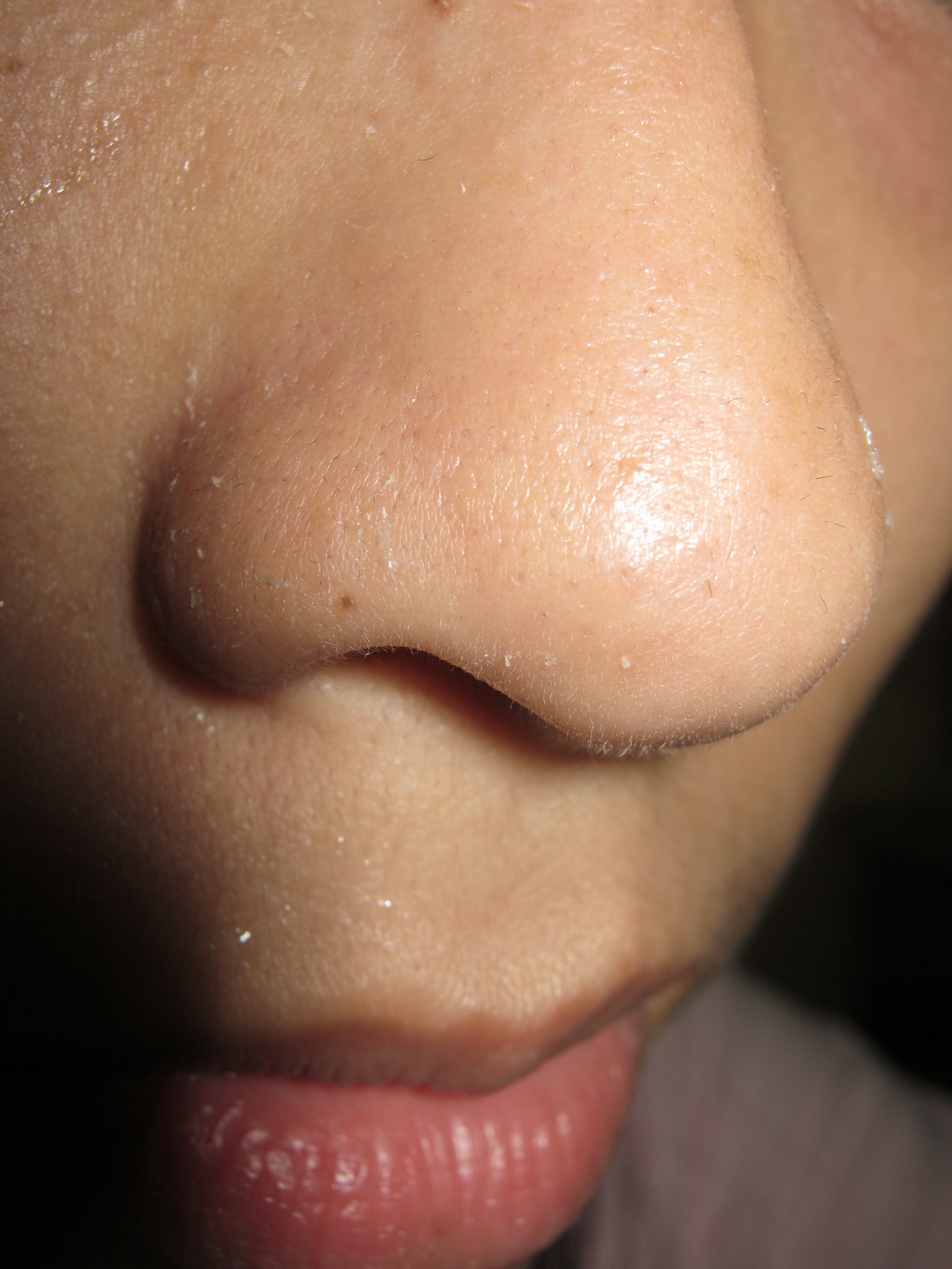 Deep Clean Pores on Nose