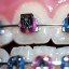 color of your braces