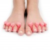 Toe Separators