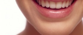 Teeth White without Whitening Strips