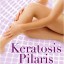 Keratosis Pilaris