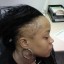 A women suffering from traction alopecia