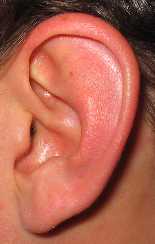 How to Treat a Childs Ear Infection