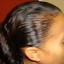 Treat a Receding Hairline for Women