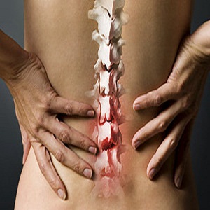 Arthritis Back Pain