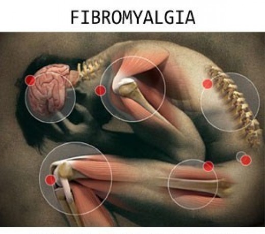 Decrease the Pain of Fibromyalgia