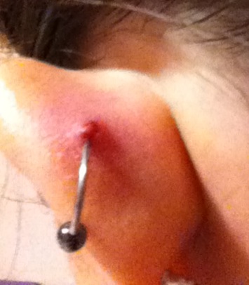 Tips to Heal Piercing Bumps