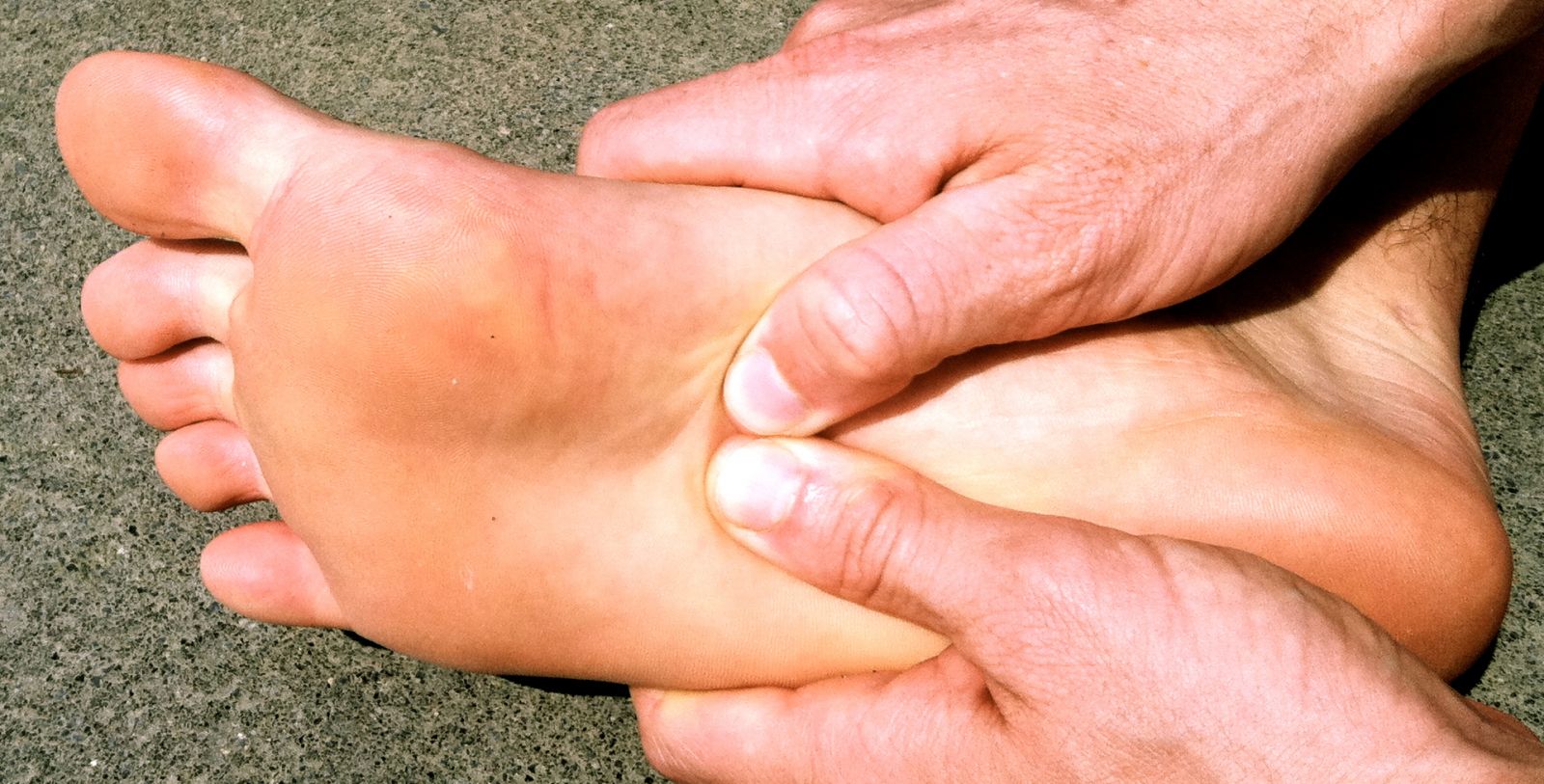 Pepper the Plantar Fascia