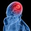 recognise symptoms of brain tumour