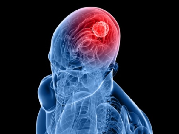 recognise symptoms of brain tumour