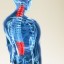 Tips about How to Treat Degenerative Disc Disease